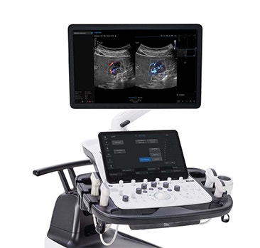 image Samsung%20V6_secondary_1