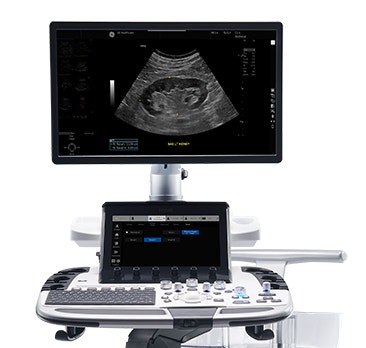 GEHC LOGIQ™ E10 Vet R5 image 3